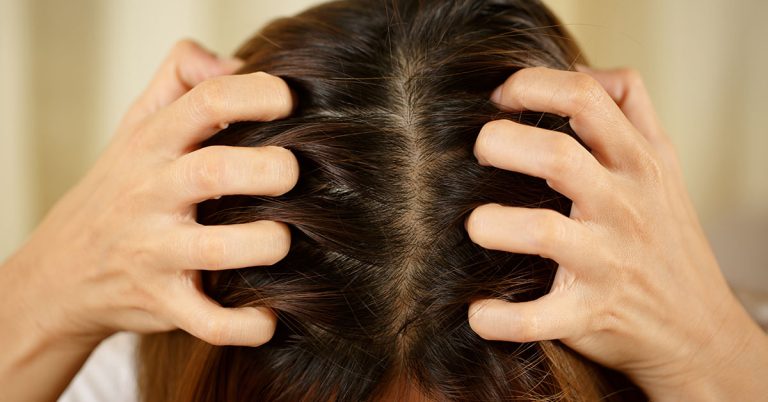 Oily Hair SOS: 3 Ways to Rescue Your Oily Scalp