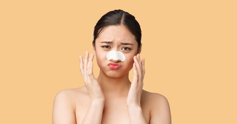 7 Dermatologists-Recommended Tips For Removing Whiteheads Without Using Products with Harsh Chemicals